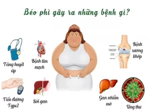 BỆNH BÉO PHÌ LÀ GÌ?